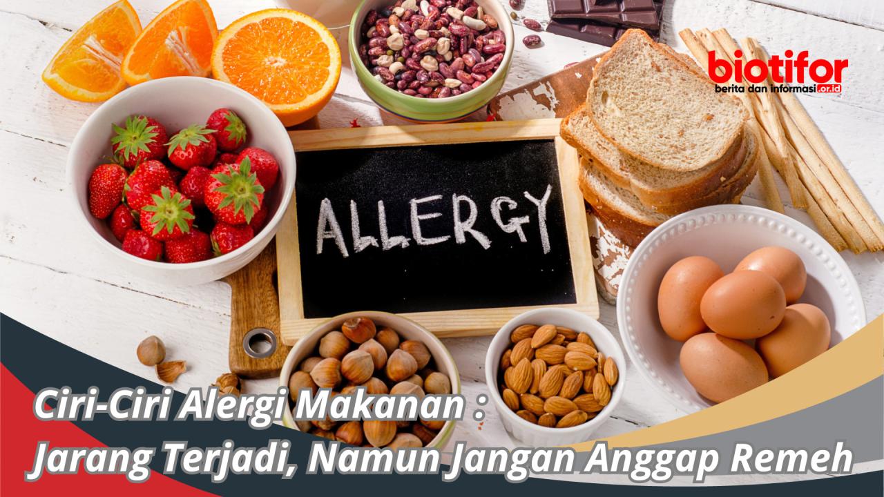 Apa Saja Gejala Alergi Makanan Yang Umum